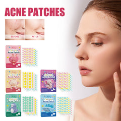 Wiieey Acne Patch Series, Reduces Pimples, Acne Scars, Spots, Cleanses Closed Comedones, and Various Designs