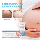 Wiieey Pregnancy Scar Care Cream, Moisturizes, Repairs Skin, Reduces Pregnancy Scars, and Smoothes Skin