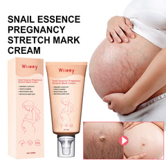 Wiieey Snail Essence Pregnancy Cream, Tightens Skin, Repairs, and Reduces Stretch Marks and Postpartum Stretch Marks