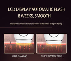 Laser Hair Removal for Women Function At-Home Permanent IPL Hair Removal Device, Flashes for Whole Body