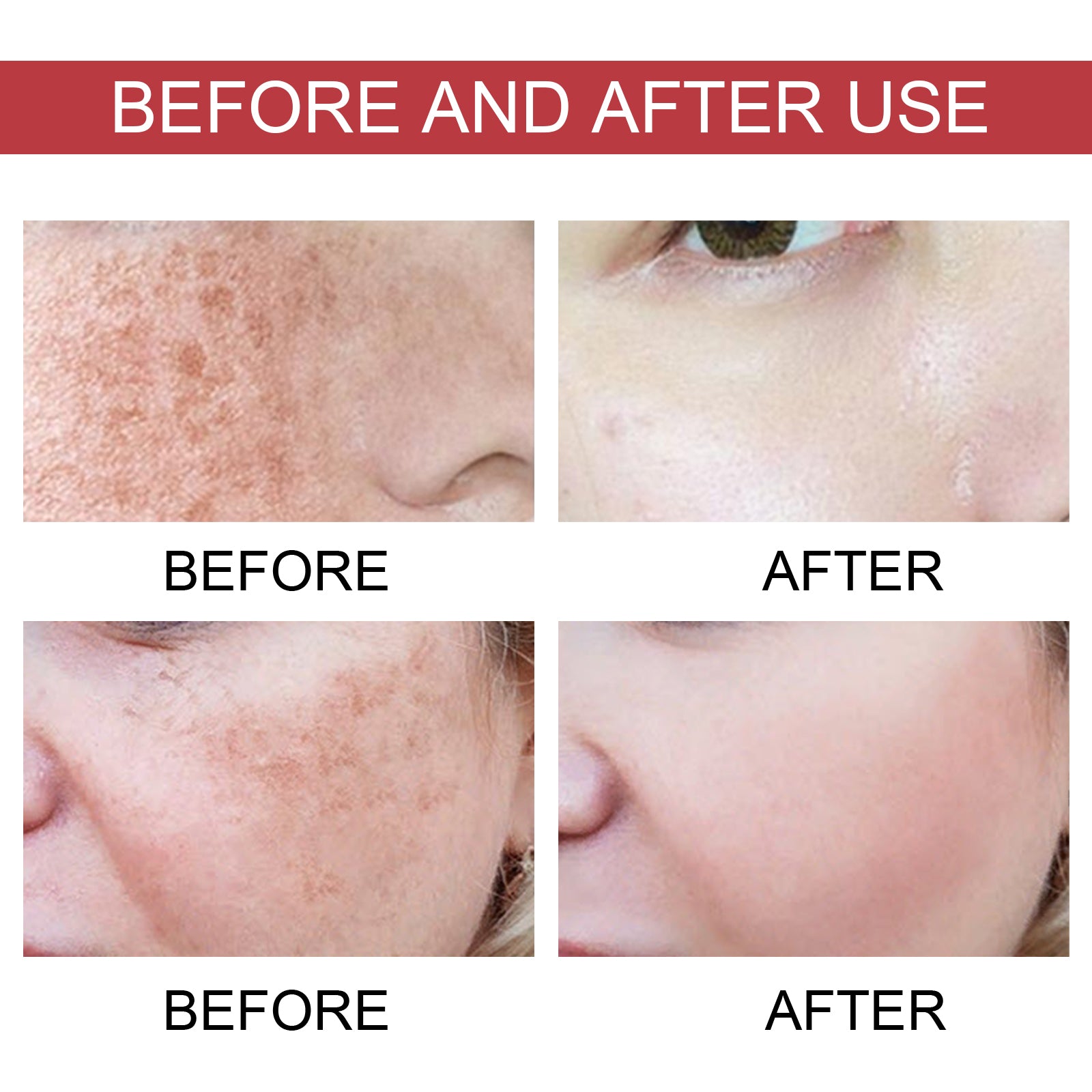 Dark Spot Correcting Serum