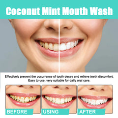 Teeth Whitening Mouthwash - Whitens teeth