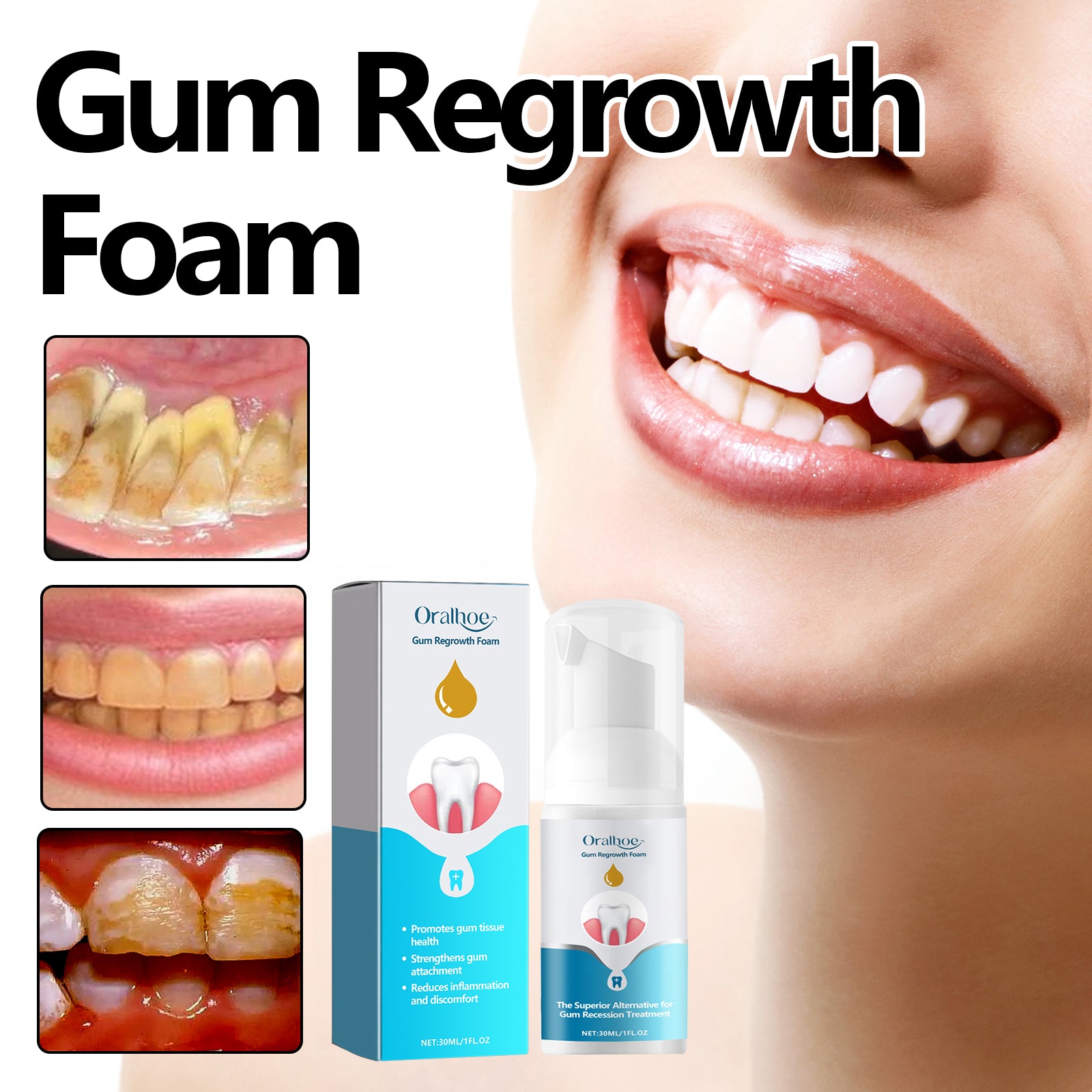 Gum Foam Mousse - Cleans teeth and dental plaque