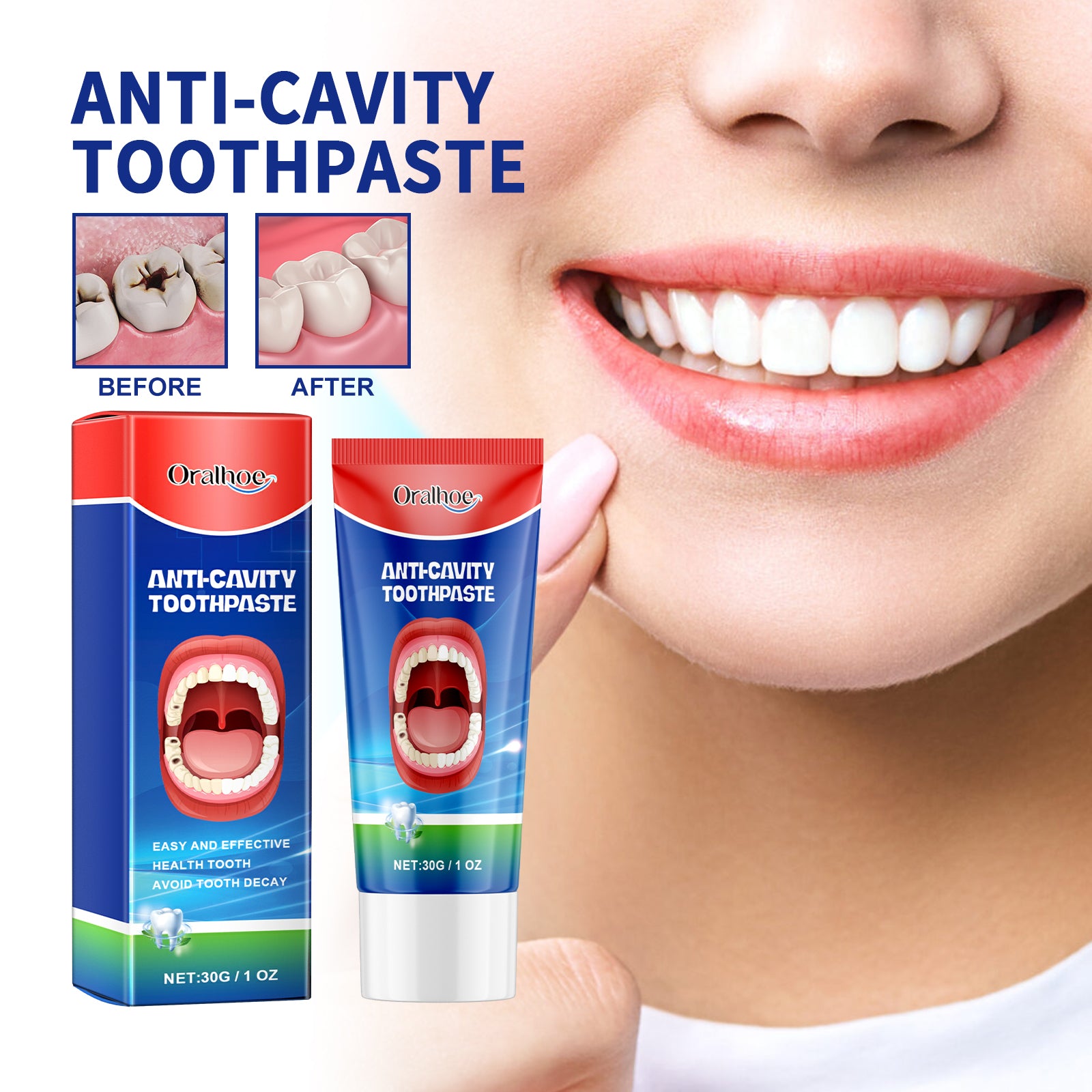 Anti-Cavity Toothpaste - Cleans the mouth, protects against yellowing and cavities