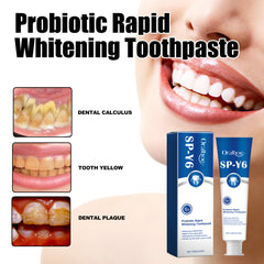 Probiotic Whitening Toothpaste - Freshens breath