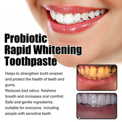 Probiotic Whitening Toothpaste - Freshens breath