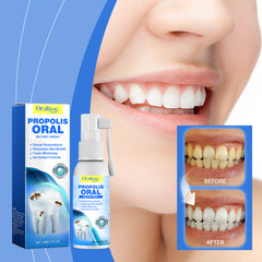 Propolis Oral Care Spray - Cleans teeth, protects gums, and freshens breath.