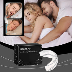 Anti-Snoring Dental Appliance - Prevents snoring at night for a peaceful sleep.