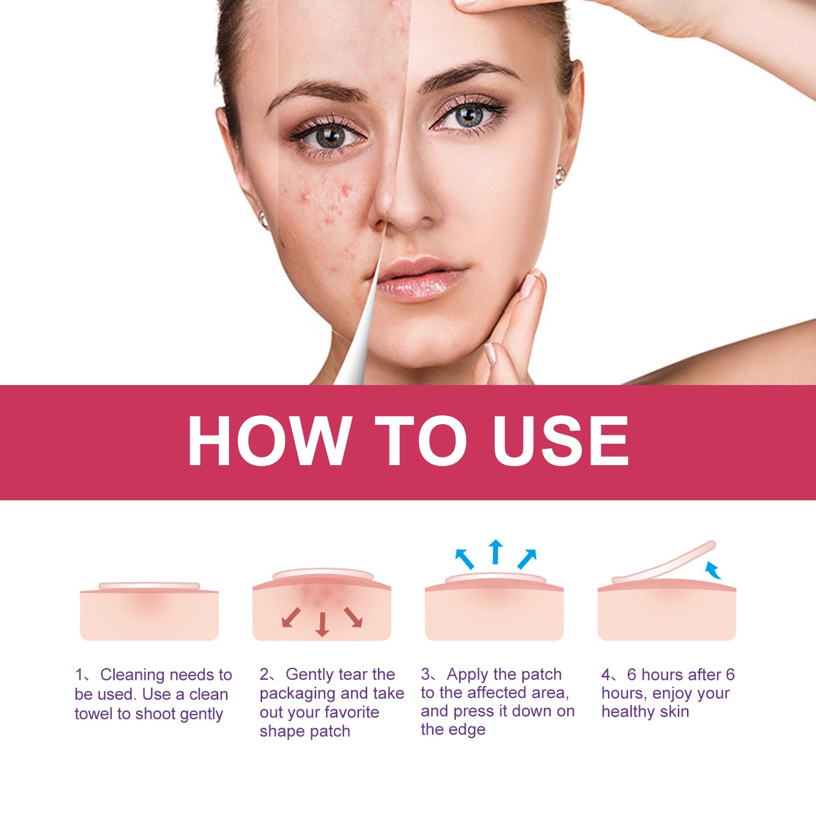 Wiieey Acne Patch Series, Reduces Pimples, Acne Scars, Spots, Cleanses Closed Comedones, and Various Designs