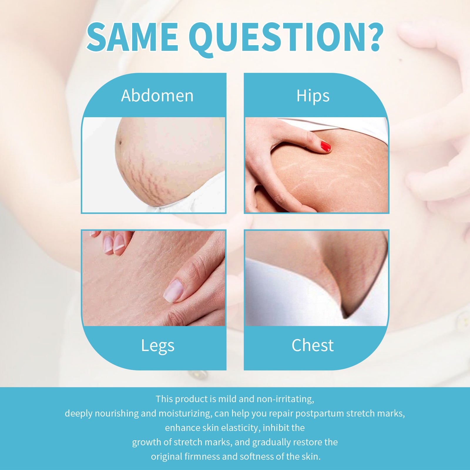Wiieey Pregnancy Scar Care Cream, Moisturizes, Repairs Skin, Reduces Pregnancy Scars, and Smoothes Skin