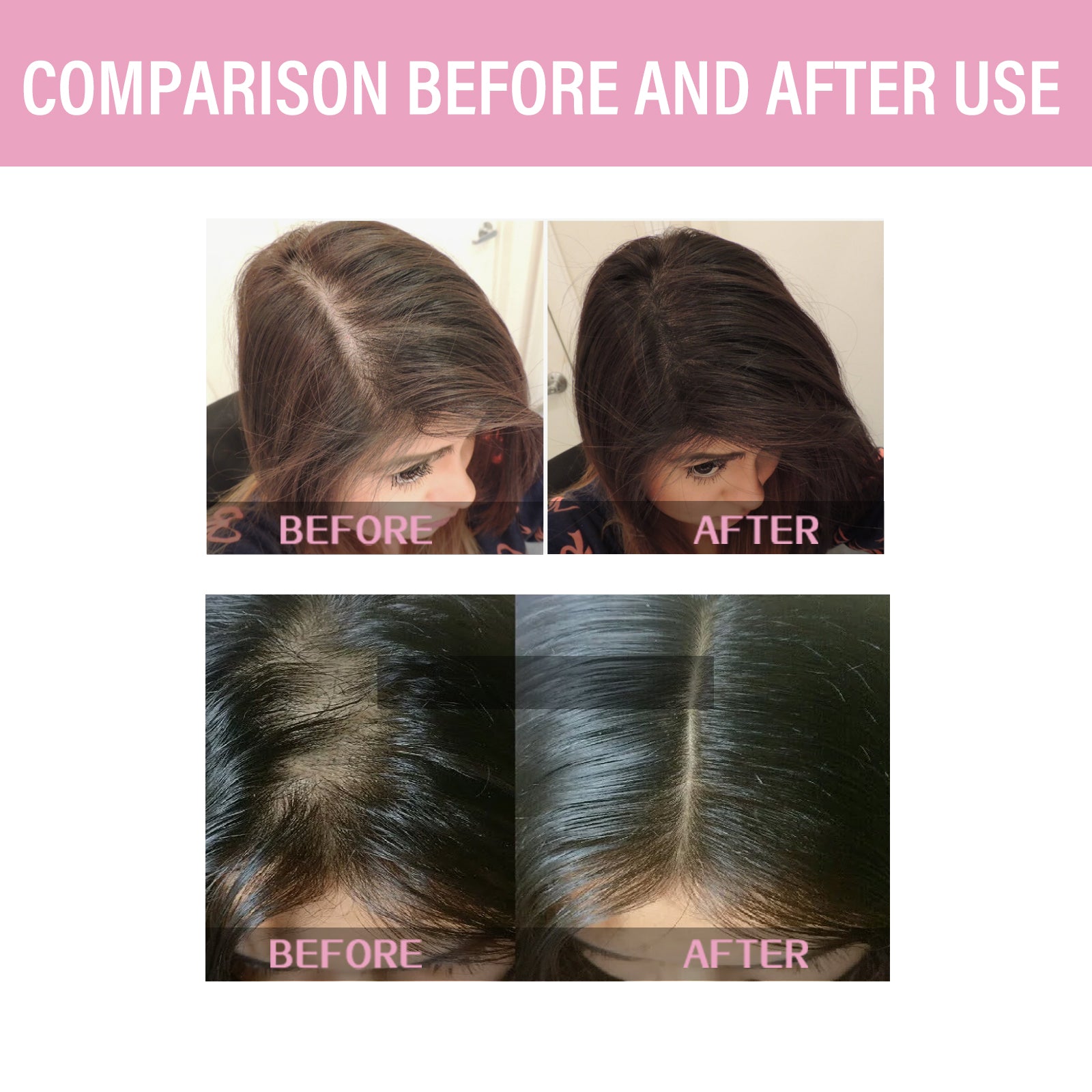 Wiieey 2-in-1 Shampoo and Body Wash, Repairs Dry Hair Ends, Massages Scalp, and Gently Cleanses and Softens Hair
