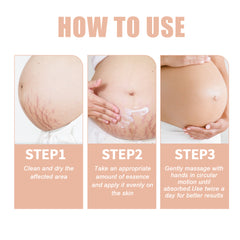 Wiieey Snail Essence Pregnancy Cream, Tightens Skin, Repairs, and Reduces Stretch Marks and Postpartum Stretch Marks