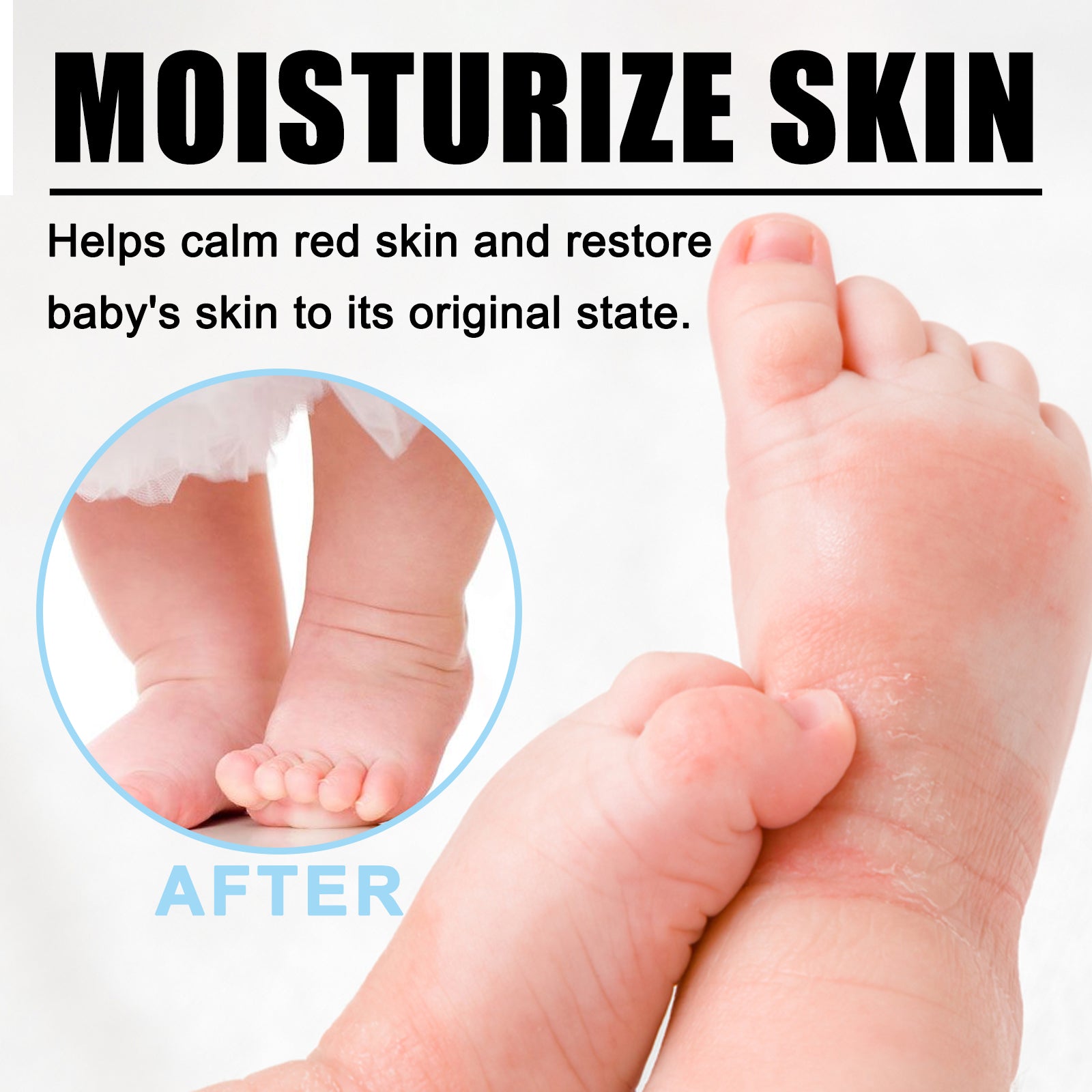 Wiieey Skin Repair Cream, Relieves Skin Redness, Itching, and Repairs, Moisturizes, and Nourishes Skin