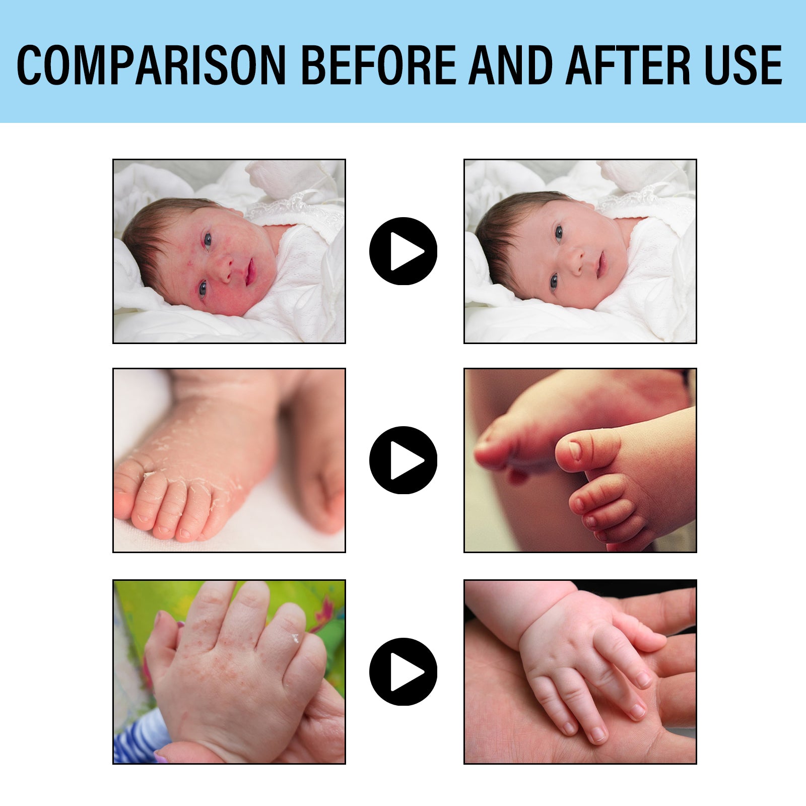 Wiieey Skin Repair Cream, Relieves Skin Redness, Itching, and Repairs, Moisturizes, and Nourishes Skin