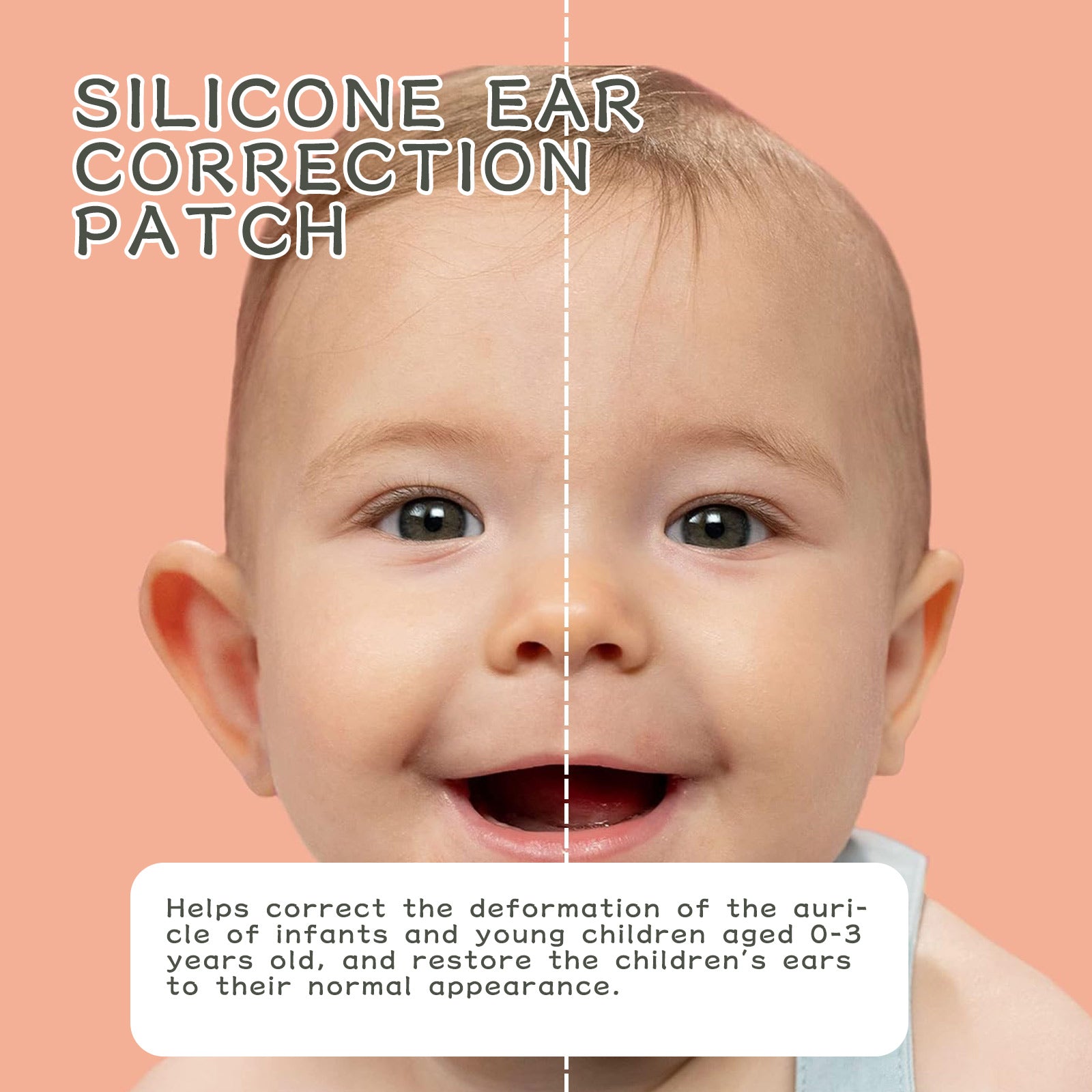 Wiieey Silicone Ear Correction Patch, Helps Correct Children's Prominent Ears, Gentle, Waterproof, and Breathable