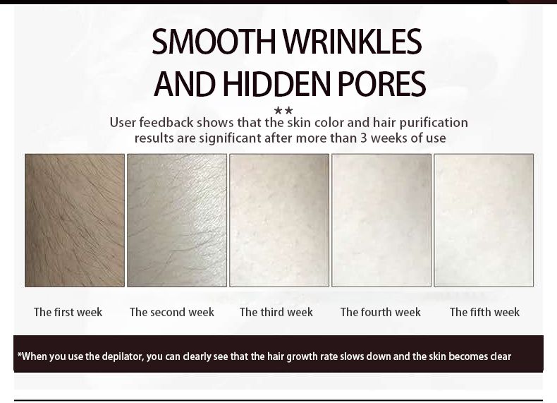 Laser Hair Removal for Women Function At-Home Permanent IPL Hair Removal Device, Flashes for Whole Body